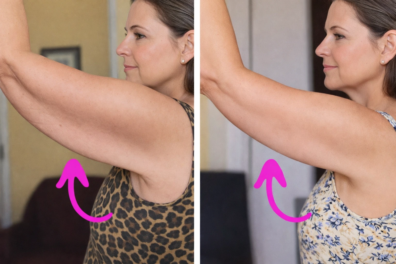 Before and after arm transformation