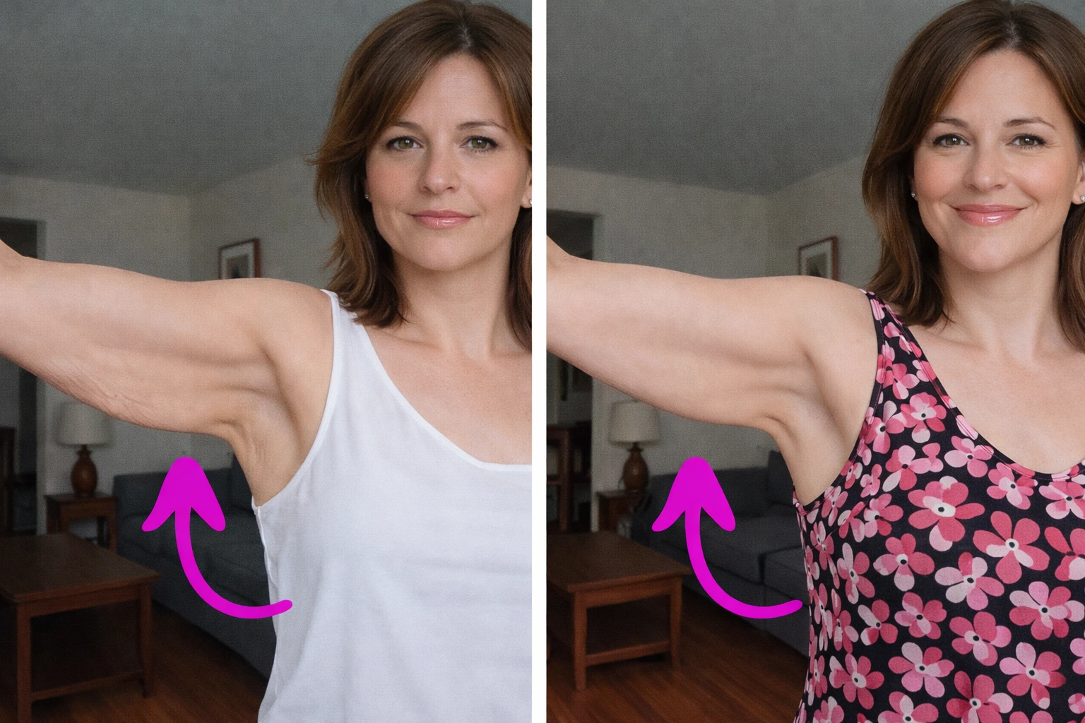 Arm sculpting results